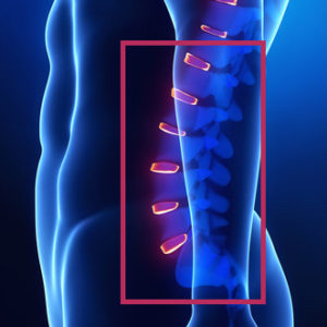 Lspine